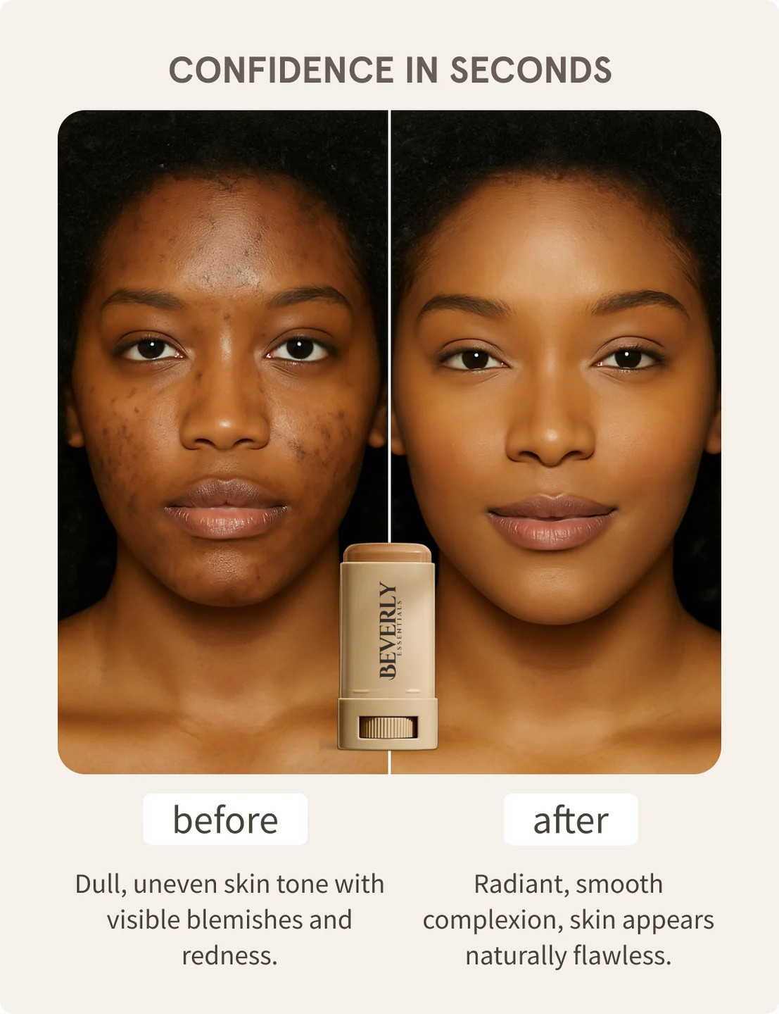 Beverly Serum™ Boosted Skin Tint Balm